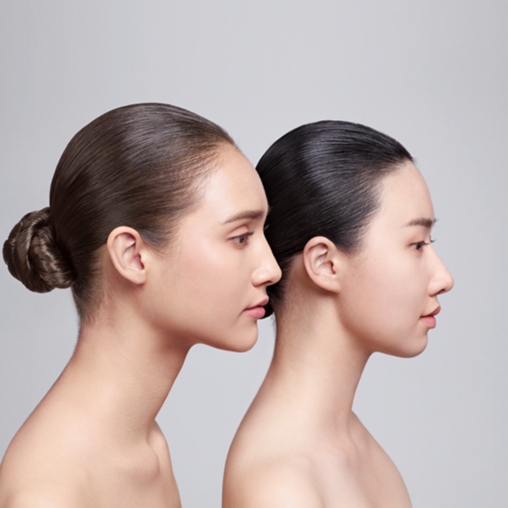[AYUNCHE] Pro Scalp Scaler (150ml)